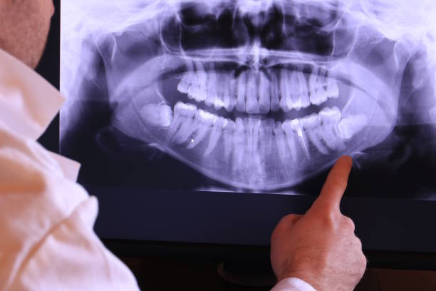 Best Emergency TMJ Treatment in Great Falls, VA