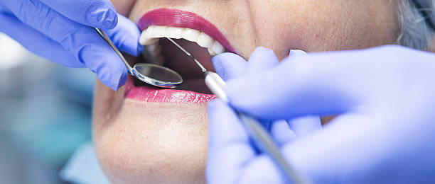 Best Emergency Dental Care for Broken or Chipped Teeth in Great Falls, VA